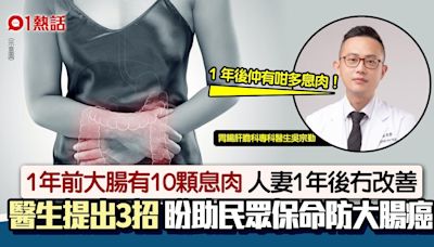 人妻1年後再照大腸鏡 醫生驚呼︰又出現滿滿息肉 籲3招預防癌魔