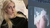 Taylor Momsen sufre ataque de un murciélago en pleno concierto: Este es su estado de salud