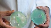 El ataque de los “clones epidémicos”: cómo una bacteria inofensiva llegó a causar medio millón de muertos al año