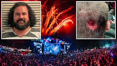 Drugged-out Florida man arrested after biting off piece of cop’s head at music festival