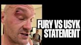 Tyson Fury vs Oleksandr Usyk rescheduled for May 18 after cut to British boxer’s face