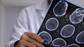 Precision Neuroscience deploys 4,096 electrodes in brain-computer interface procedure