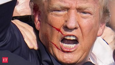 Donald Trump assassination attempt: Where are the stitches? Where are the scars?" Know in detail. - The Economic Times