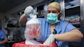First person to receive a genetically modified pig kidney transplant dies nearly 2 months later