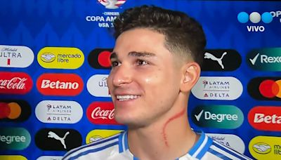 El arañazo en el cuello que se llevó Julián Álvarez de recuerdo tras el partido ante Canadá