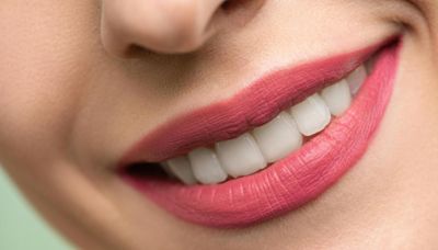 7 trucos para tener dientes blancos y eliminar las manchas