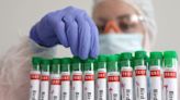 Australia detects H7 bird flu at egg farm