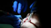 US dental care crisis: It should not be a luxury to keep your teeth in your mouth