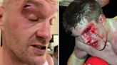 'Horrific' reason Tyson Fury vs Oleksandr Usyk fight could be stopped