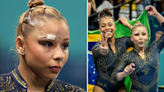 Gymnast suffers nasty cut and black eye after scary fall but wins Olympic medal