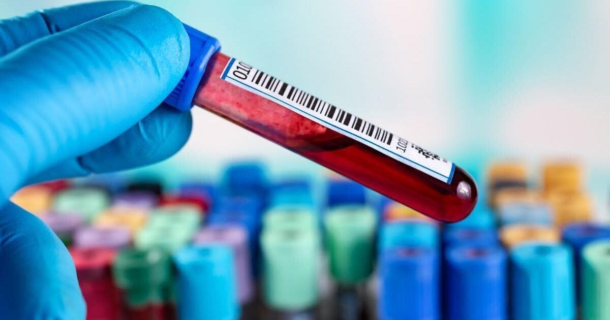 Blood Test 91% Accurate at Predicting Alzheimer's, Outperforming Doctors