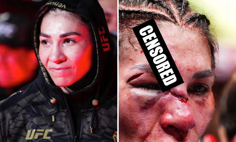 UFC 306 before/after photos of Irene Aldana's massive gory forehead cut are what horror movies are made from