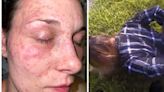 Police In Texas Held Woman's Face Down To Fire Ants, Federal Lawsuit Says