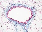 Masson's trichrome stain