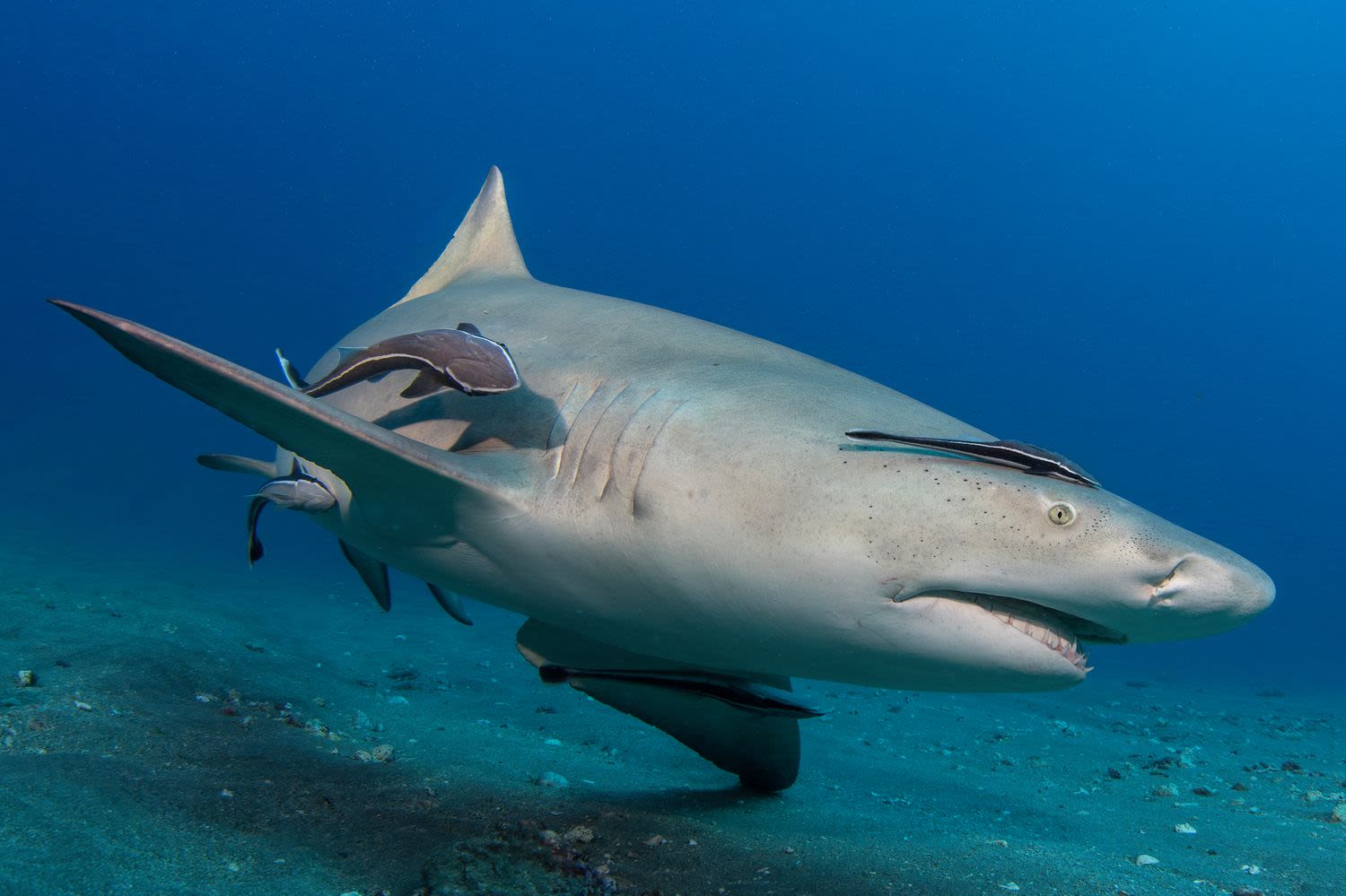 Shark Bites Florida Man Leaving Him in Critical Condition with 'Severe' Injuries to His Arm