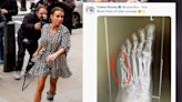 Coleen Rooney shares X-ray of broken foot after Rebekah Vardy suggests she was ‘milking’ injury in court