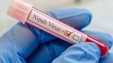 Nipah virus infection confirmed in 14-year-old boy in Kerala, says Health Minister Veena George