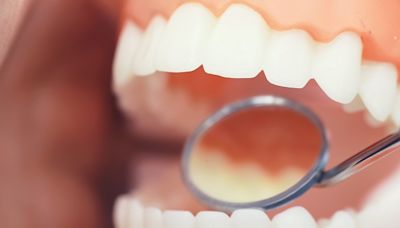 The Importance of Regular Dental Check-Ups