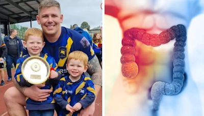 Rugby Captain Who Thought He Was ‘Just Tired’ Diagnosed With Bowel Cancer; Know Other Deadly Symptoms To Watch Out