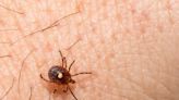 Tick-Borne Alpha-Gal Syndrome Might Be More Widespread than We Realized