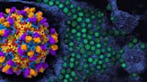 NIH announces start of Phase I enterovirus D68 therapeutic clinical trial