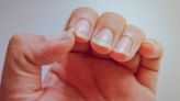 Dile adiós a las uñas quebradizas con estos 5 consejos de expertos