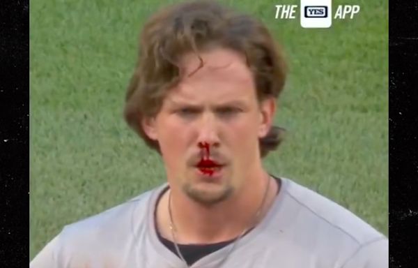 Orioles' Adley Rutschman Suffers Gnarly Nosebleed After Faceplanting On Field