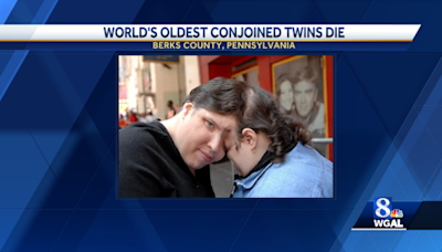 Oldest living conjoined twins die at 62 in Pennsylvania