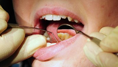 Children in most-deprived areas ‘three times more likely’ to need teeth removed