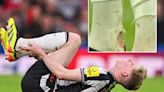 'Prime example to get rid of VAR' moan Newcastle fans as Gordon shows off scar