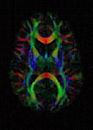 Diffusion MRI