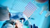 Axsome Therapeutics settles Sunosi patent litigation with Unichem Laboratories