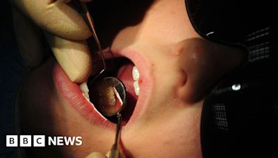 Fluoridisation in north-east England gives only "modest benefits"