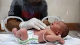 Gaza hospital says newborn saved from dead mother's womb