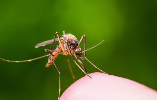 Can’t stop itching your mosquito bites? Here's how to get rid of the urge to scratch.