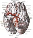 Circle of Willis