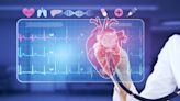 UltraSight and Mayo Clinic join forces for AI-driven cardiac care