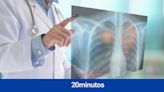 Madrid participa en un estudio internacional que aumenta un 20% la supervivencia en pacientes con cáncer de pulmón