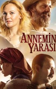 Annemin Yarasi