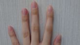 指甲看健康！中醫診所分享指甲7外觀、4顏色要留意