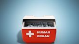 N.Y. can boost organ donation rates & save lives