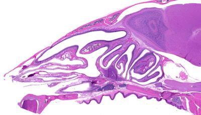 Finding immune cells under our very noses: Antibody-producing cells discovered inside the nasal conchae