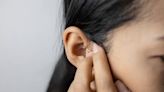 Preauricular Lymph Nodes: What to Know