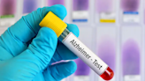 Blood tests for Alzheimer's may be coming to your doctor's office. Here's what to know - ET HealthWorld