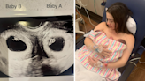 Mum with two uteruses welcomes twins in one in 50 million birth