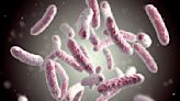 Legionnaires Outbreak in New York City Leads to 18 Sick and 1 Dead