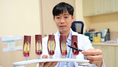 8旬婦長期胸痛「心肌灌注掃描」驚見右冠狀動脈幾乎全塞 - 自由健康網