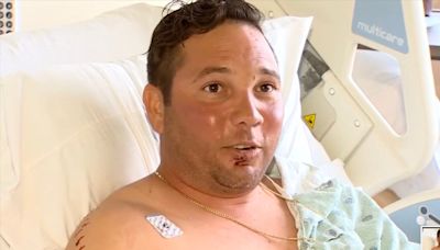 Fisherman ‘lucky to be alive’ after being attacked by bull shark in front of his children