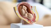 Menarini’s non-invasive foetal test can detect foetal abnormalities