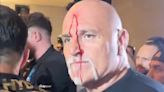 Pai de Tyson Fury fica coberto de sangue após confusão com equipe de Usyk; veja vídeo